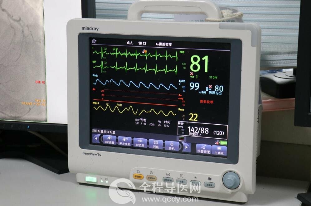 徐州市三院心臟團隊于長城心臟病學大會CTO論壇直播超高難度冠心病介入手術