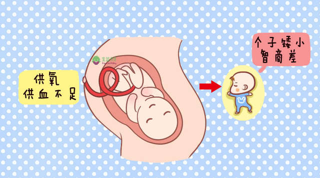 孕婦突發宮內窘迫,胎兒危急